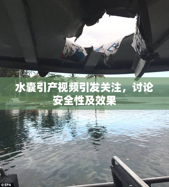 水囊引产视频引发关注，讨论安全性及效果