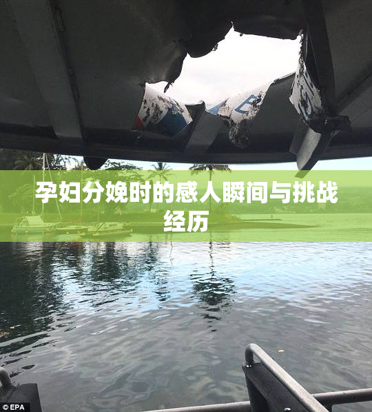 孕妇分娩时的感人瞬间与挑战经历