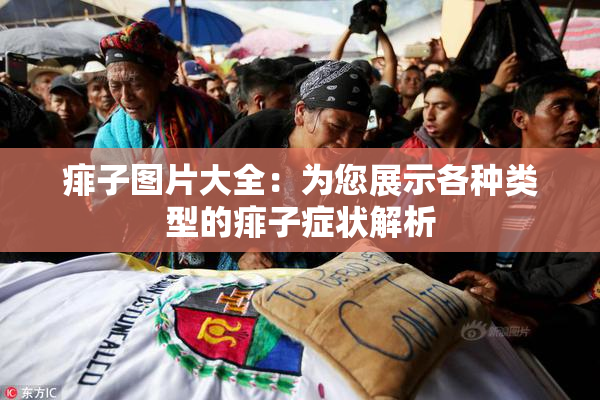 痱子图片大全：为您展示各种类型的痱子症状解析