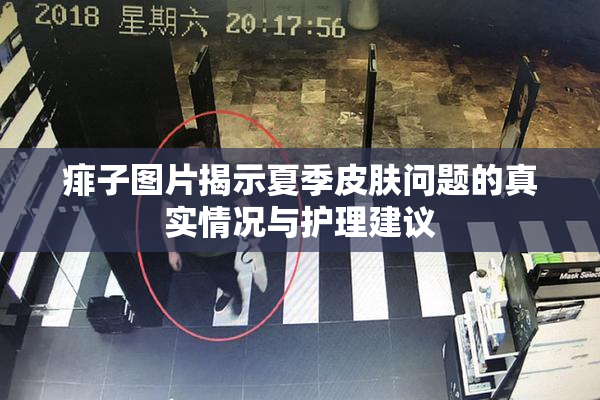 痱子图片揭示夏季皮肤问题的真实情况与护理建议