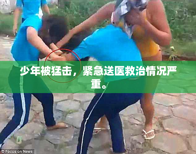 少年被猛击，紧急送医救治情况严重。