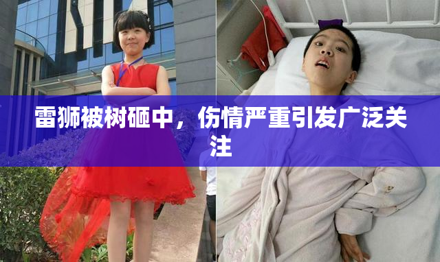 雷狮被树砸中，伤情严重引发广泛关注