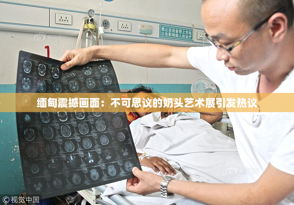 缅甸震撼画面：不可思议的奶头艺术展引发热议