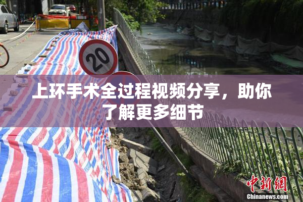 上环手术全过程视频分享，助你了解更多细节