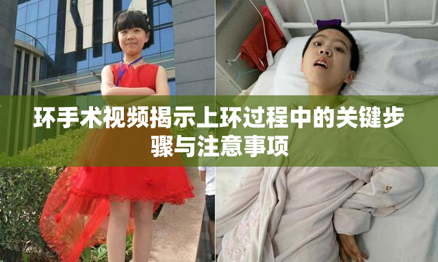 环手术视频揭示上环过程中的关键步骤与注意事项