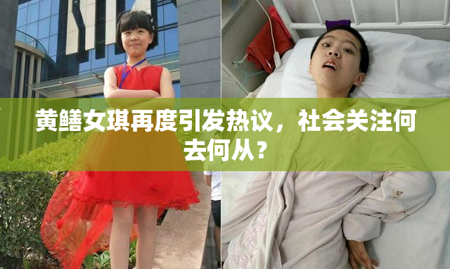 黄鳝女琪再度引发热议，社会关注何去何从？