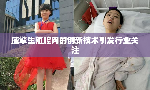 威擎生殖腔肉的创新技术引发行业关注