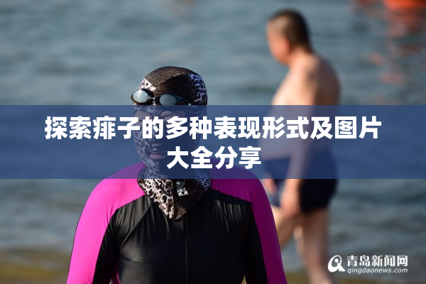 探索痱子的多种表现形式及图片大全分享