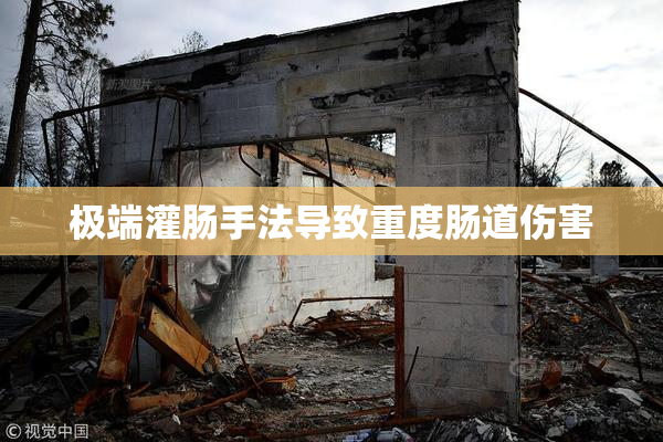 极端灌肠手法导致重度肠道伤害
