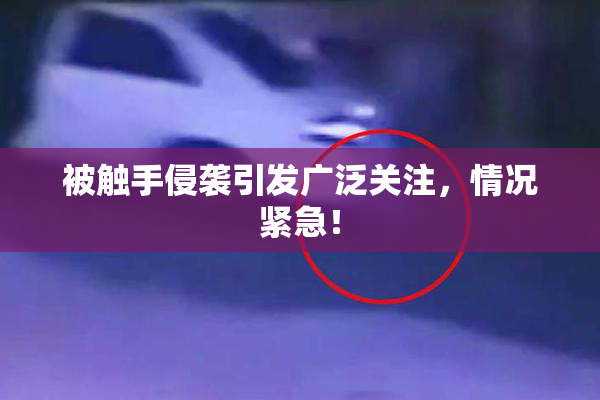 被触手侵袭引发广泛关注，情况紧急！