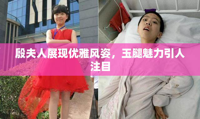 殷夫人展现优雅风姿，玉腿魅力引人注目