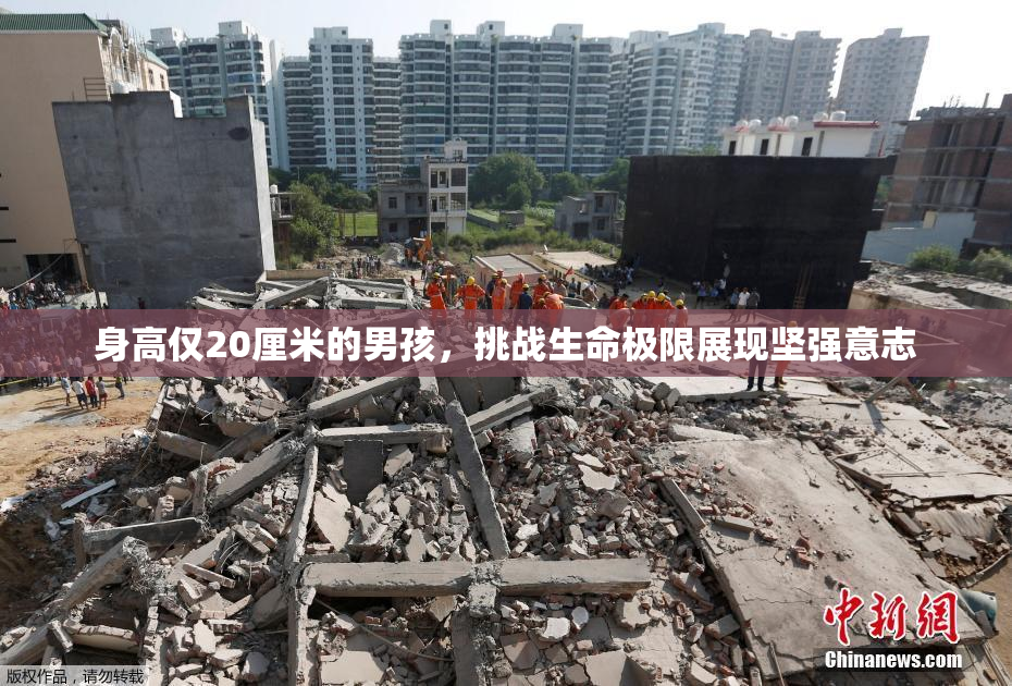 身高仅20厘米的男孩，挑战生命极限展现坚强意志