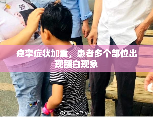 痉挛症状加重，患者多个部位出现翻白现象
